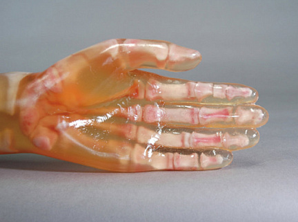 Фантом для имитации перелома руки/предплечья Ref. 41350-000-11 Fractured Hand/Forearm Phantom